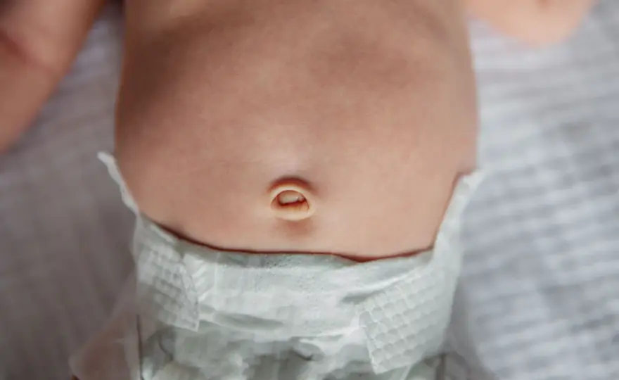 Zapalenie pępka u dziecka - Kiedy do lekarza? Pielęgnacja